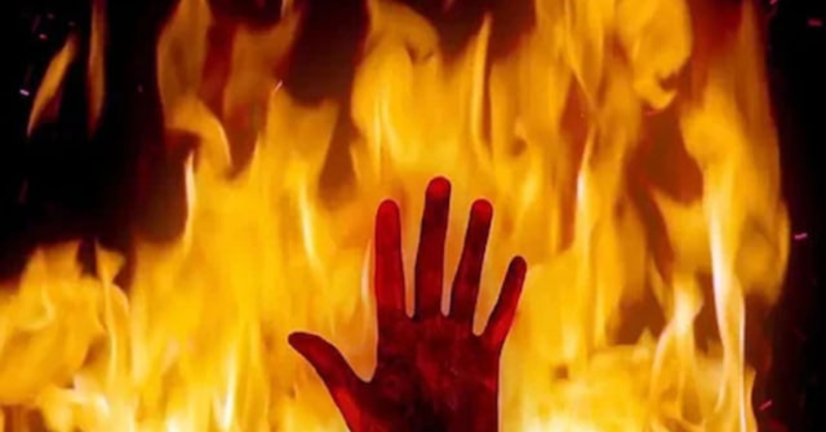 Lakhimpur Kheri News: दिवाली पर पत्नी के मायके से घर न आने से आहत पति ने खुद को लगाई आग, अस्पताल में भर्ती हालत गंभीर